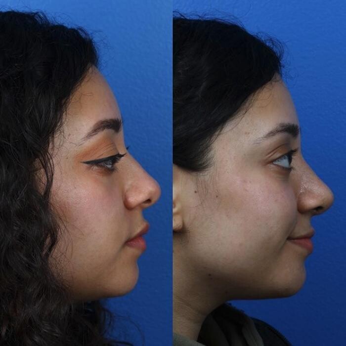 Images Gotham Plastic Surgery