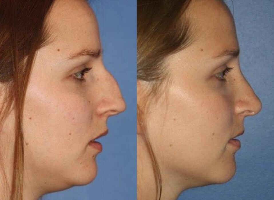 Images Gotham Plastic Surgery