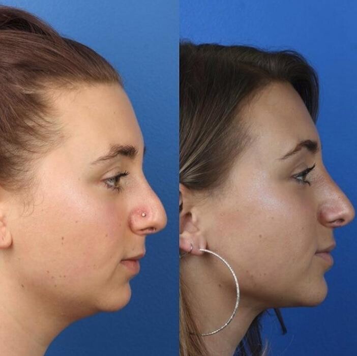 Images Gotham Plastic Surgery