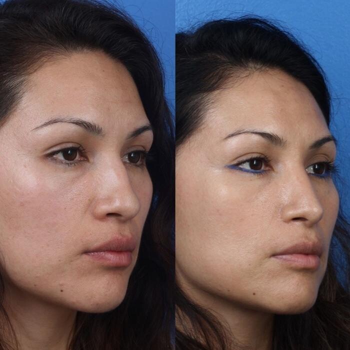 Images Gotham Plastic Surgery