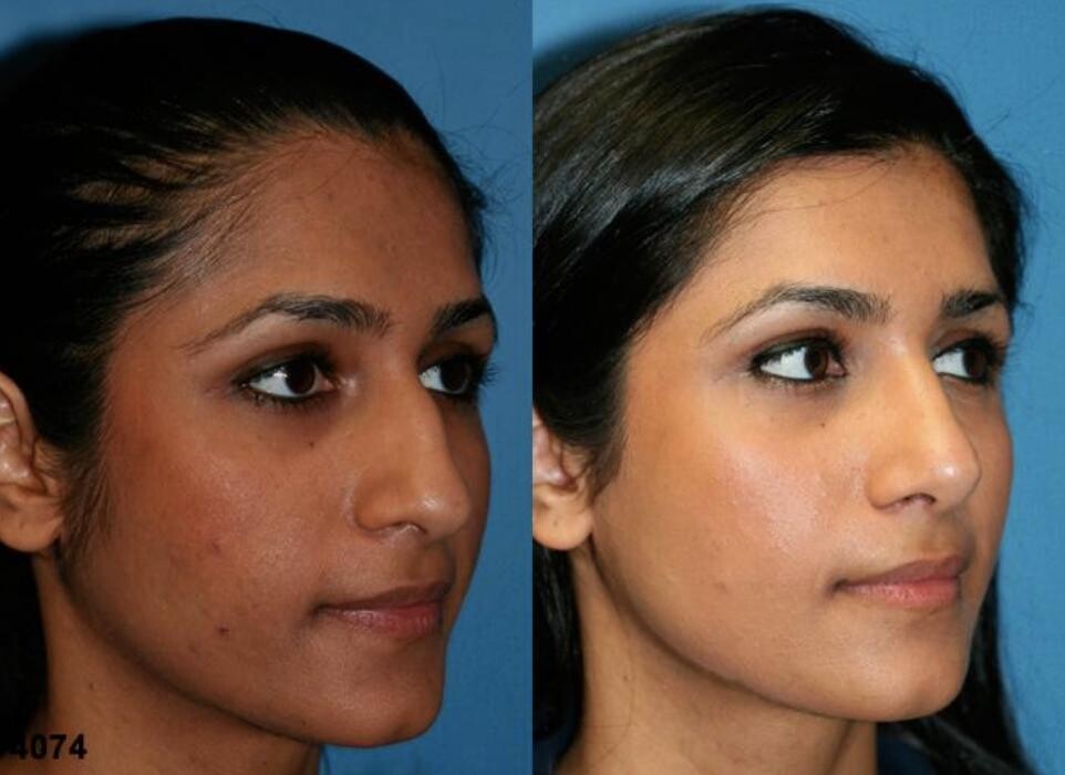 Images Gotham Plastic Surgery