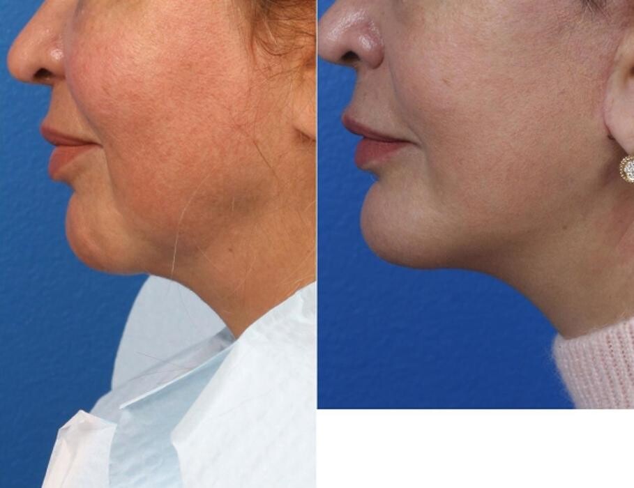 Images Gotham Plastic Surgery