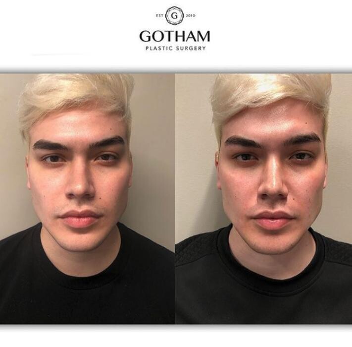 Images Gotham Plastic Surgery