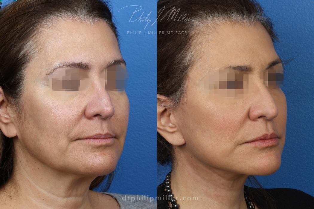 Images Gotham Plastic Surgery