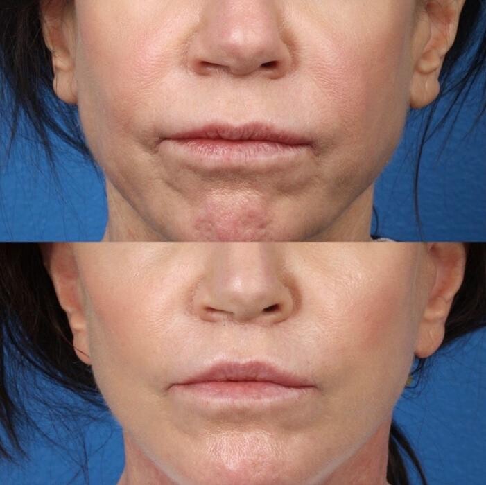 Images Gotham Plastic Surgery