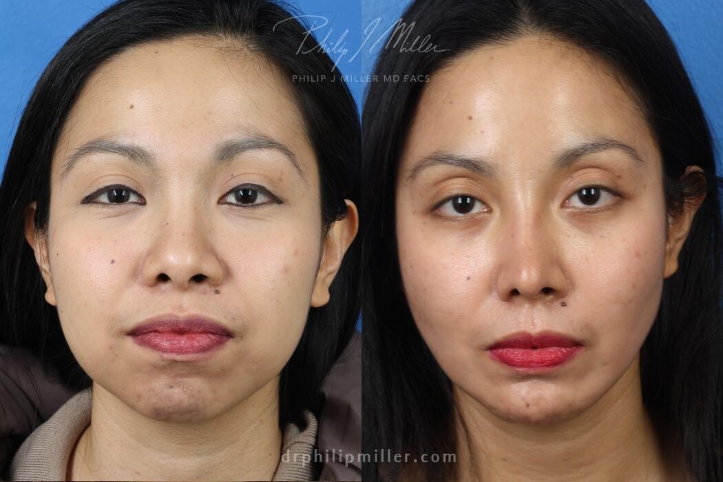 Images Gotham Plastic Surgery