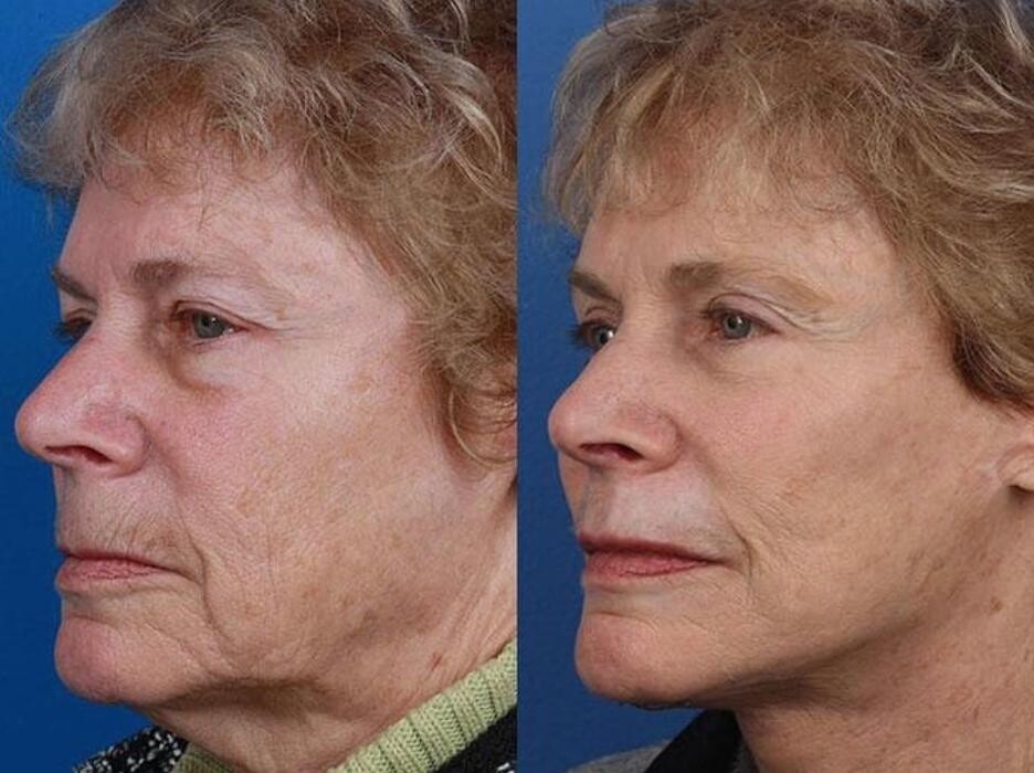 Images Gotham Plastic Surgery