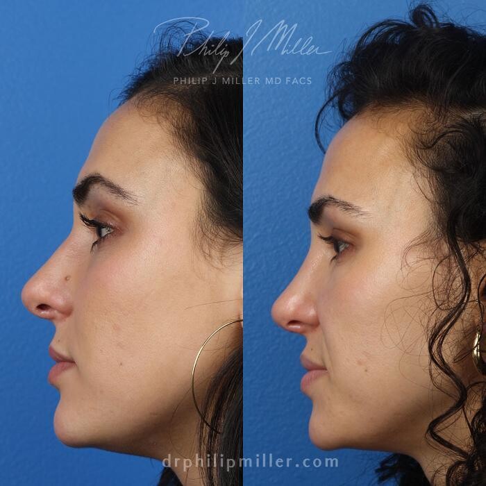 Images Gotham Plastic Surgery