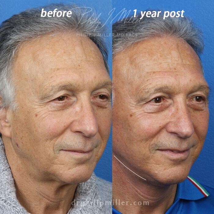 Images Gotham Plastic Surgery