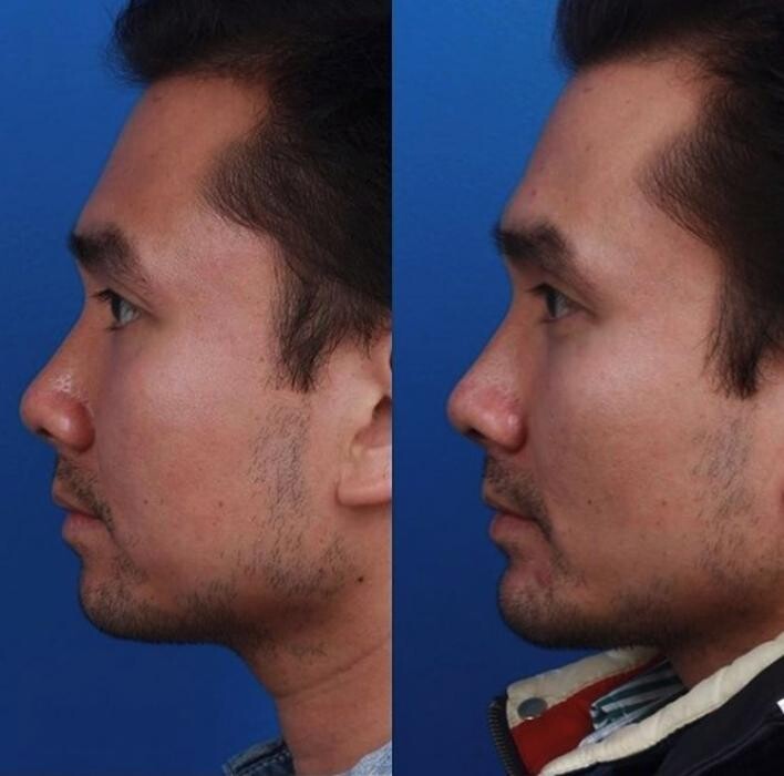 Images Gotham Plastic Surgery