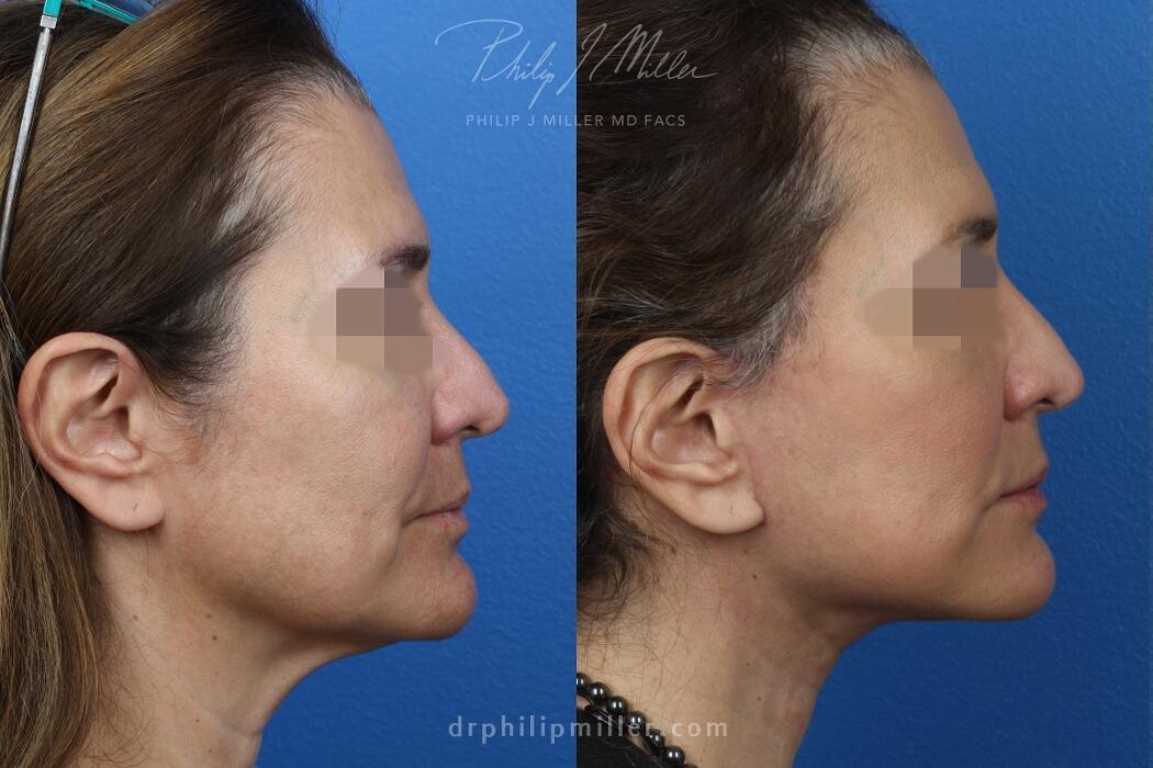 Images Gotham Plastic Surgery