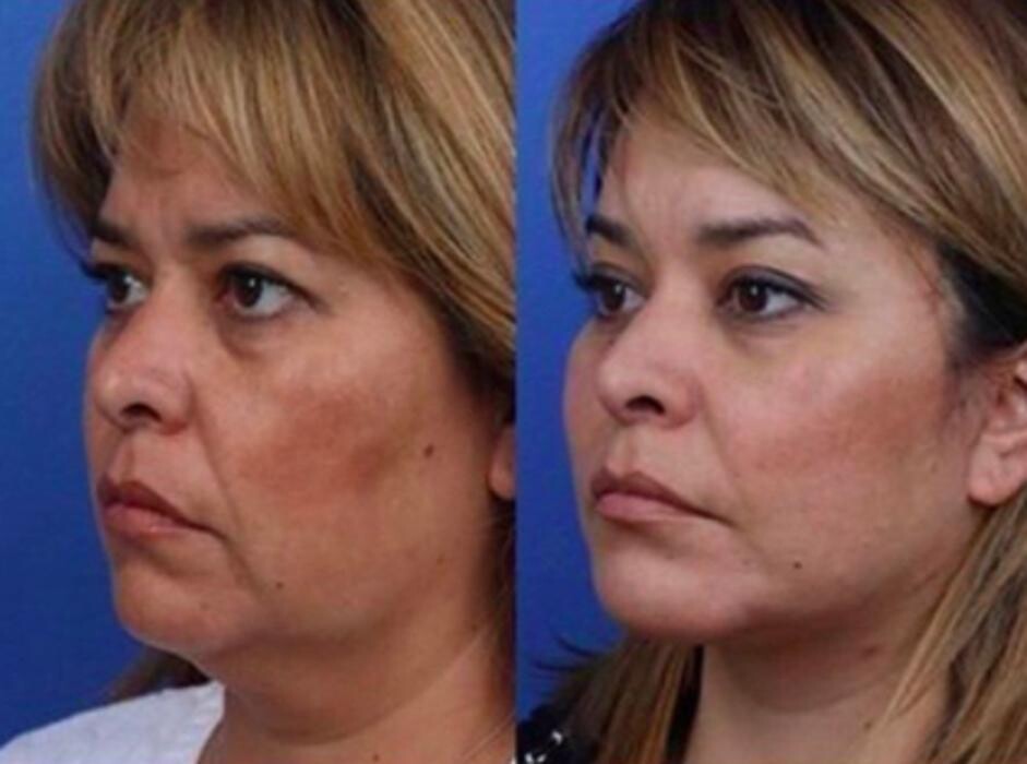 Images Gotham Plastic Surgery