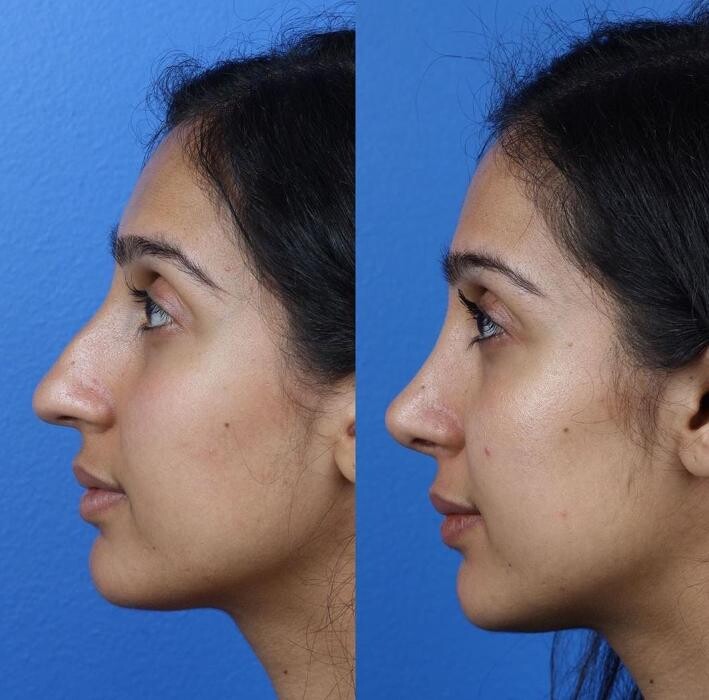 Images Gotham Plastic Surgery