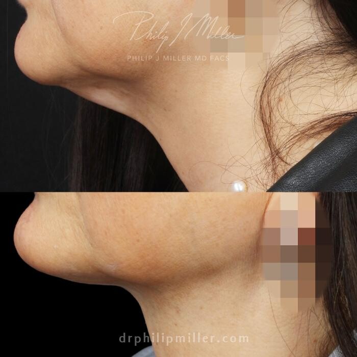 Images Gotham Plastic Surgery