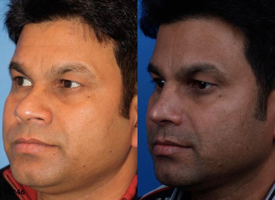 Images Gotham Plastic Surgery