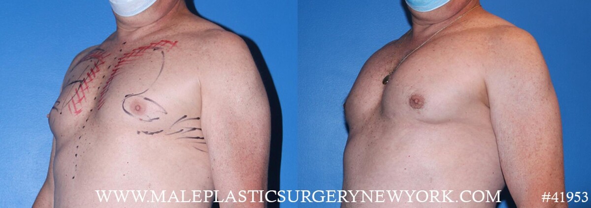 Images Gotham Plastic Surgery