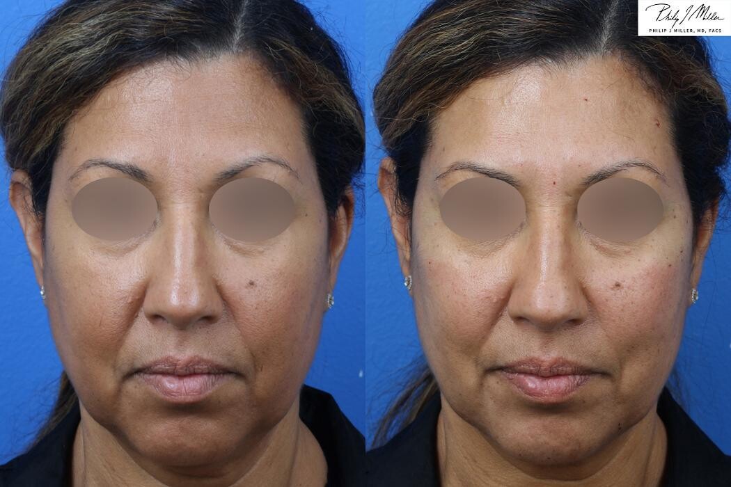 Images Gotham Plastic Surgery