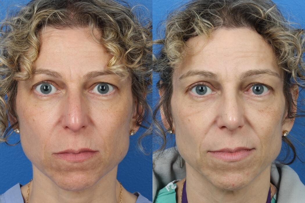 Images Gotham Plastic Surgery