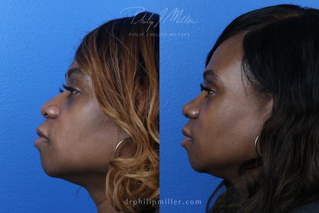 Images Gotham Plastic Surgery