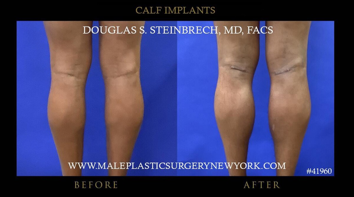 Images Gotham Plastic Surgery