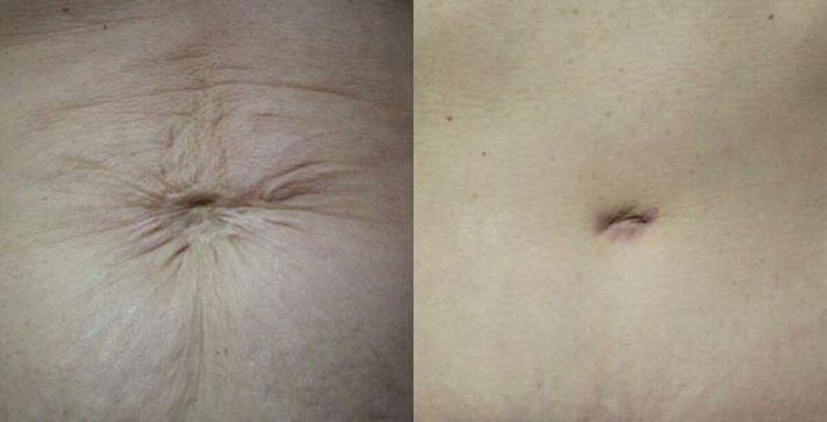 Images Gotham Plastic Surgery