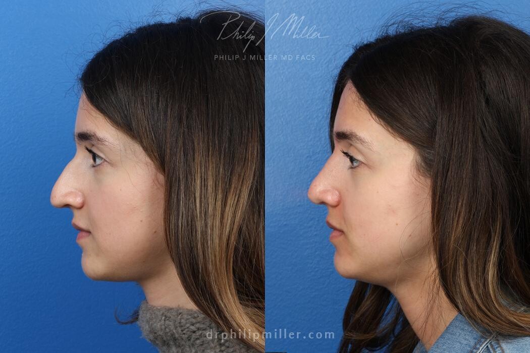 Images Gotham Plastic Surgery
