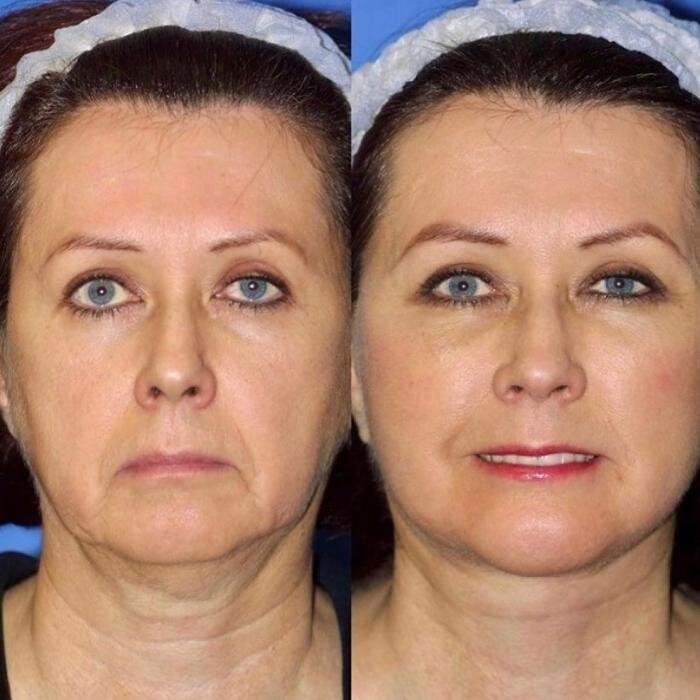 Images Gotham Plastic Surgery