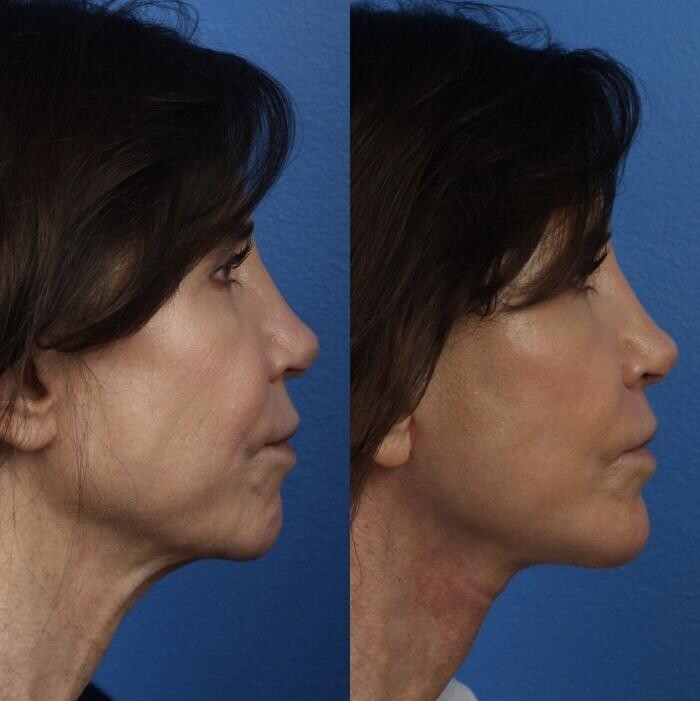 Images Gotham Plastic Surgery