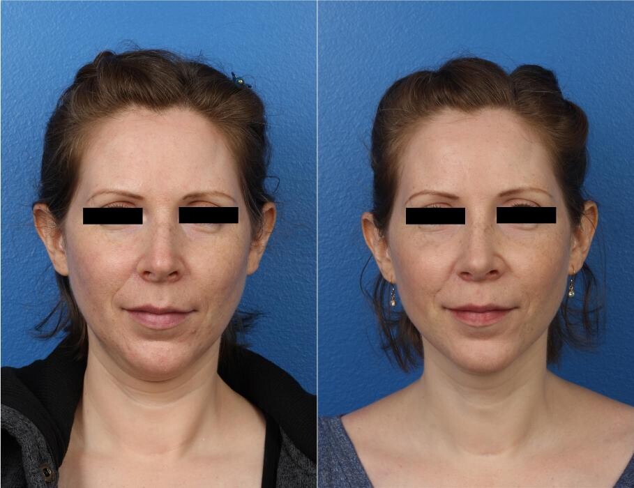 Images Gotham Plastic Surgery