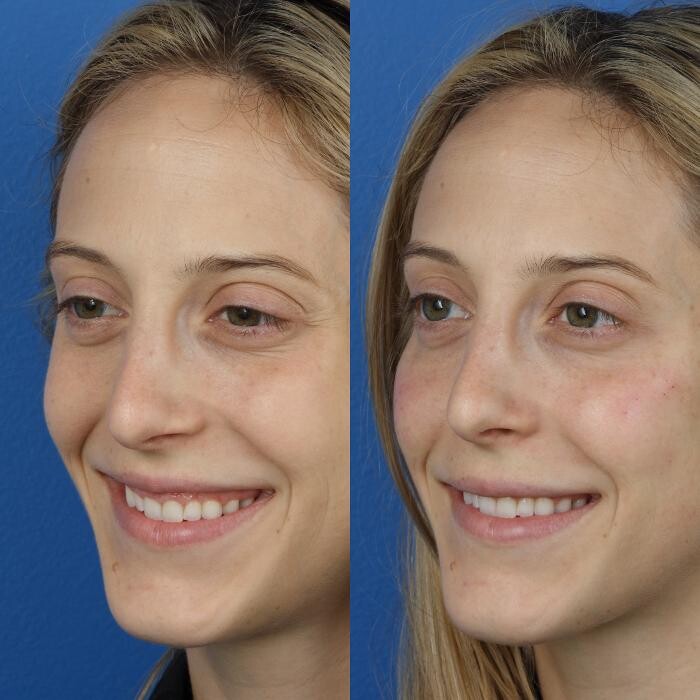 Images Gotham Plastic Surgery