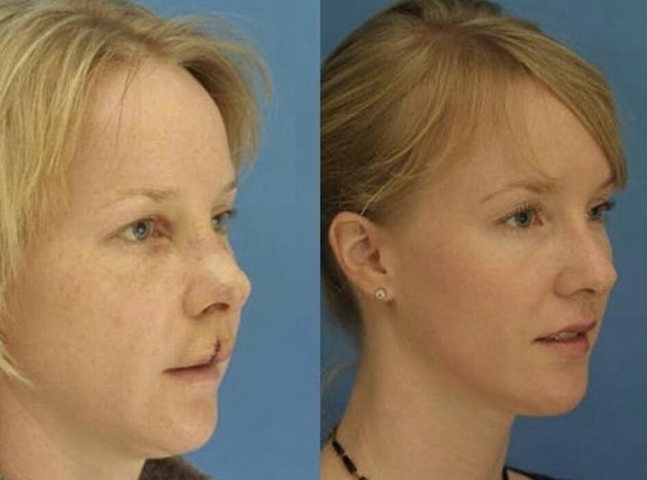 Images Gotham Plastic Surgery