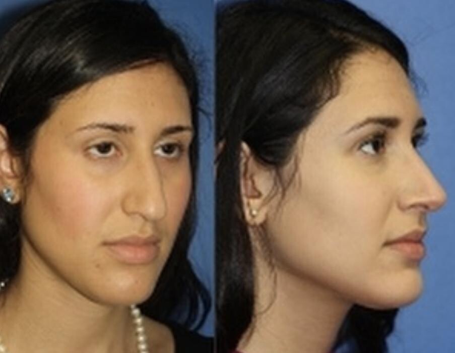 Images Gotham Plastic Surgery