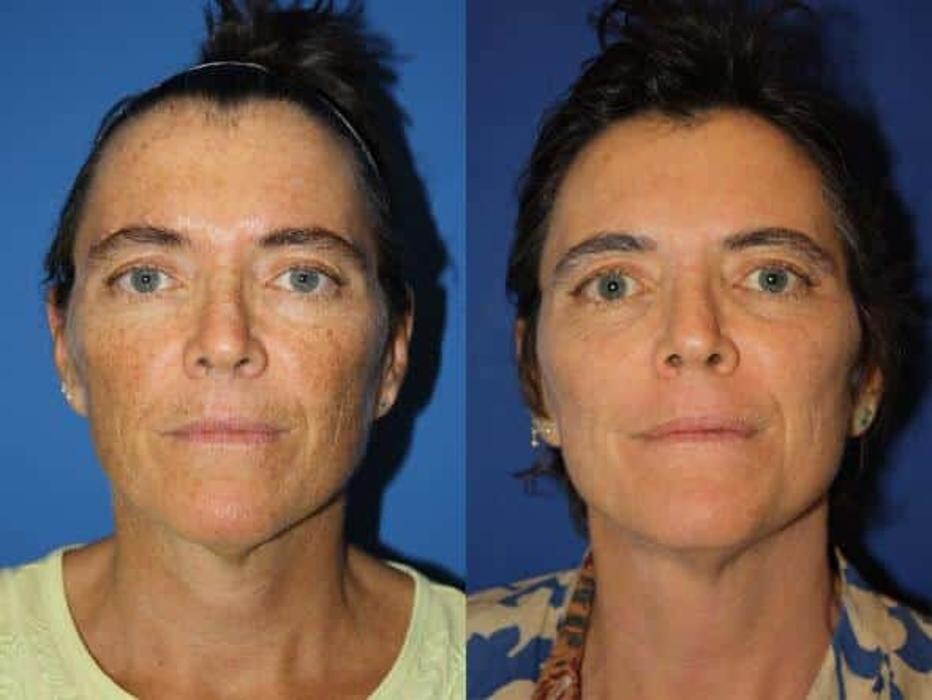 Images Gotham Plastic Surgery