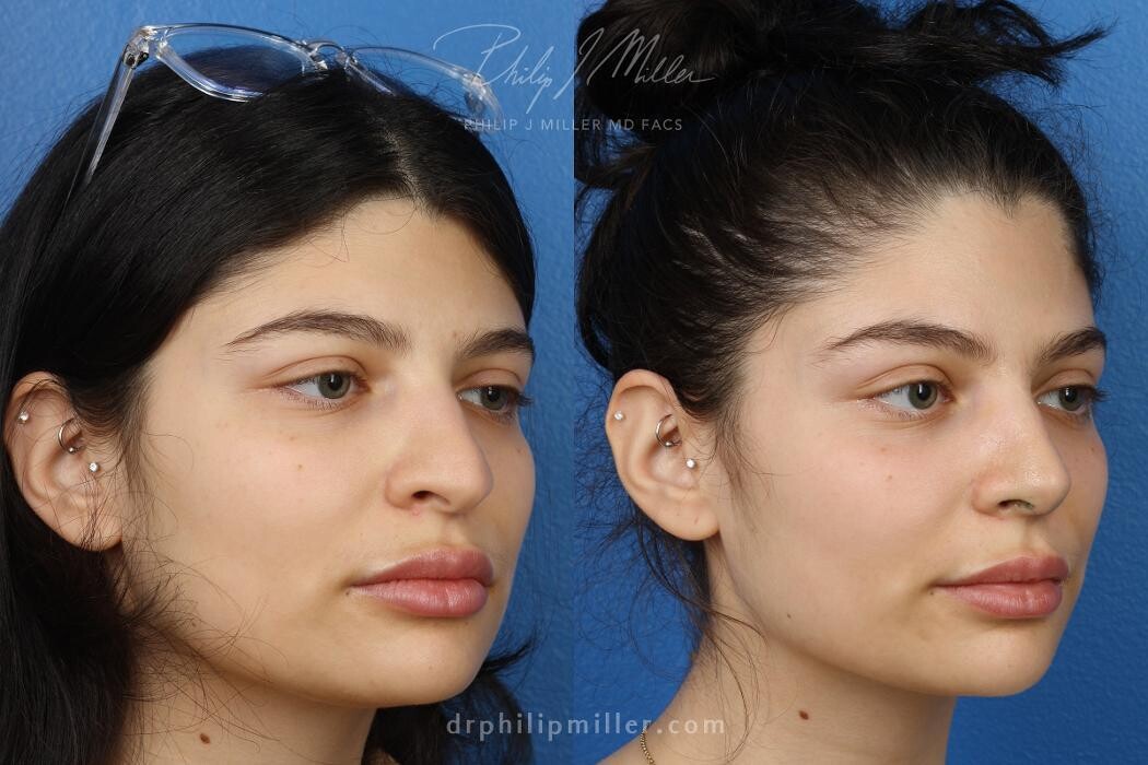Images Gotham Plastic Surgery
