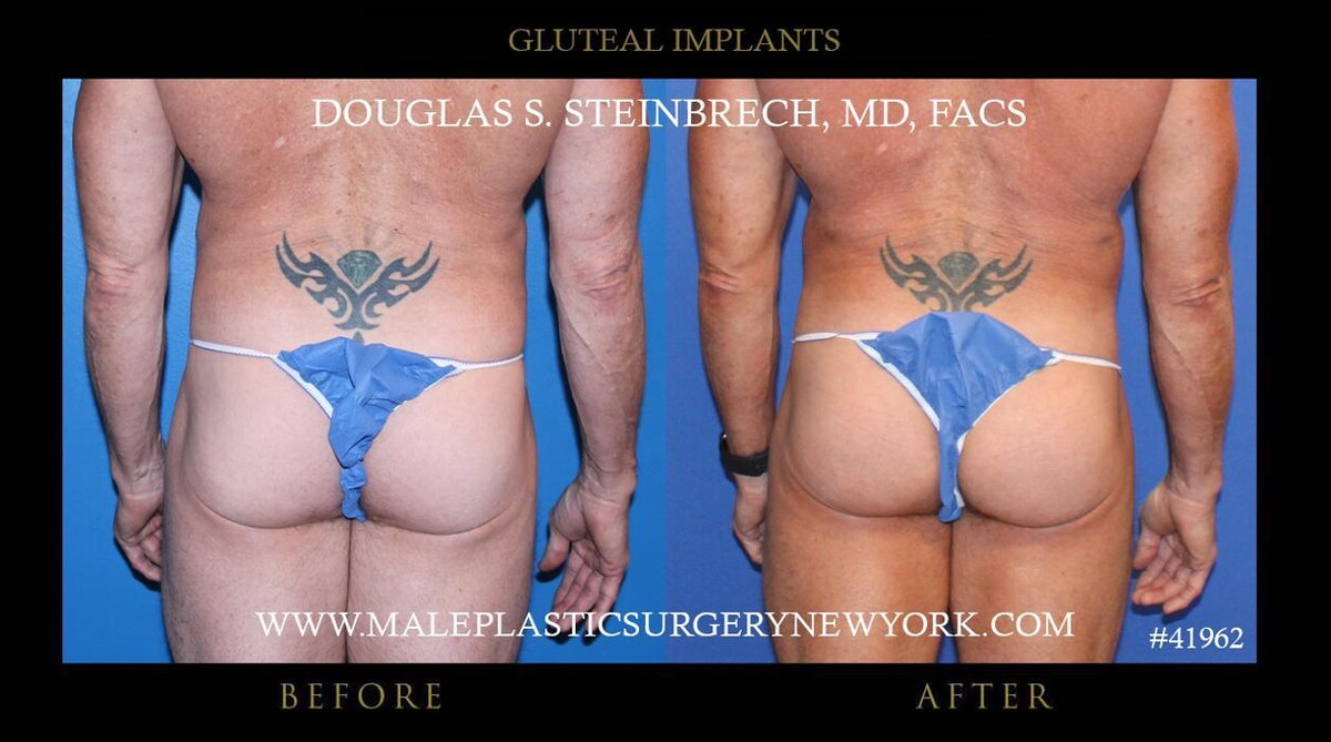 Images Gotham Plastic Surgery
