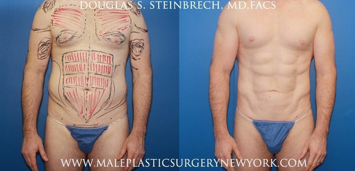 Images Gotham Plastic Surgery
