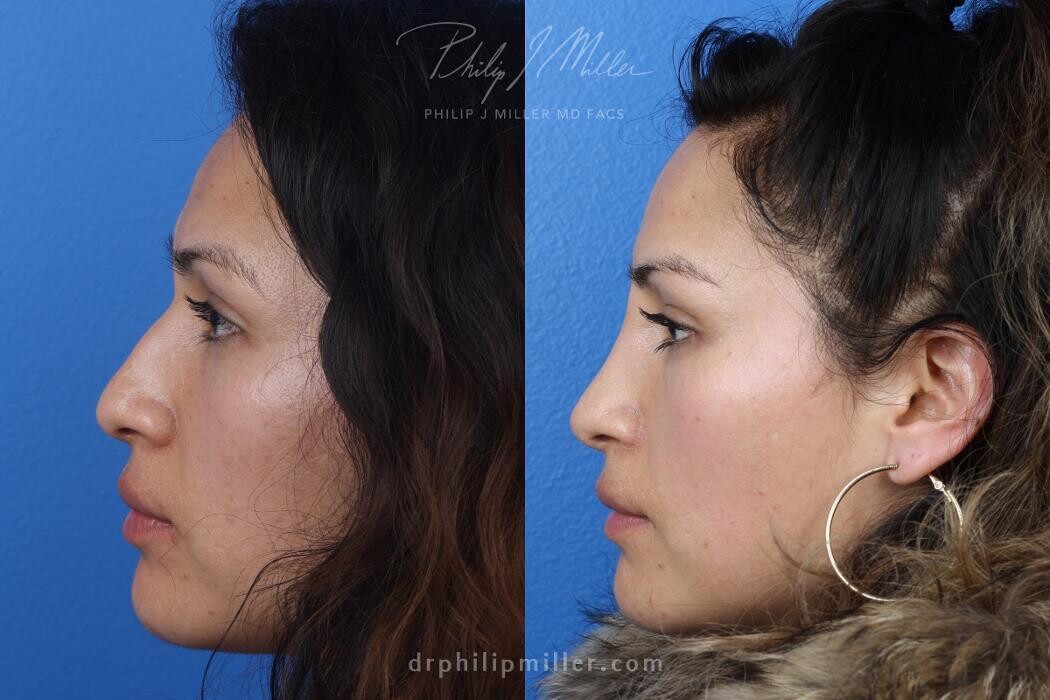 Images Gotham Plastic Surgery