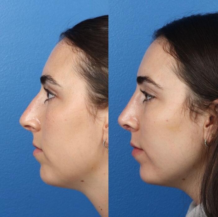 Images Gotham Plastic Surgery