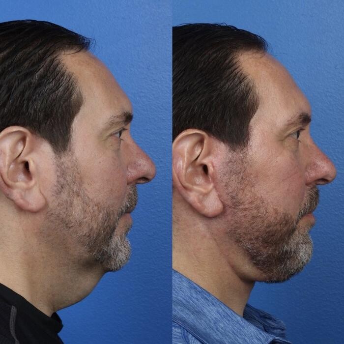 Images Gotham Plastic Surgery