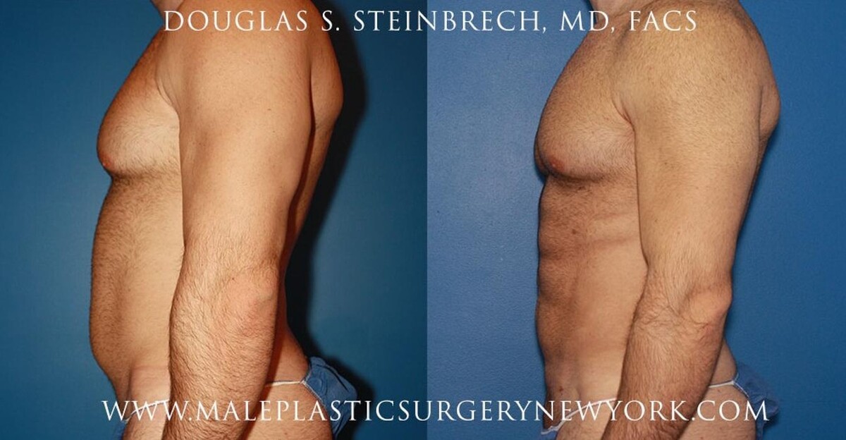 Images Gotham Plastic Surgery