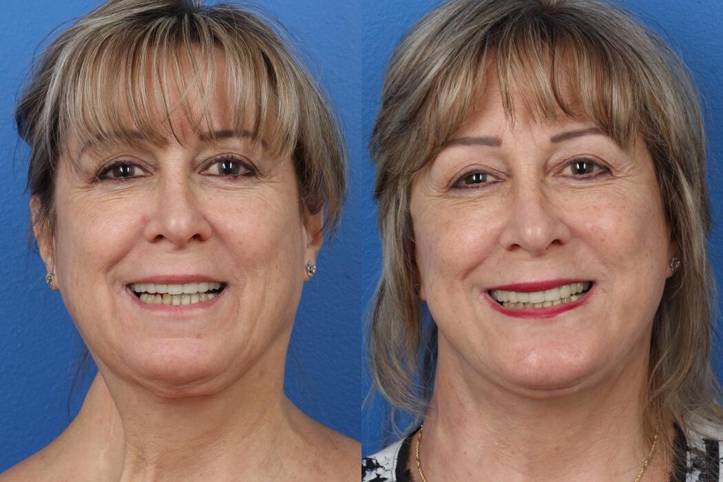 Images Gotham Plastic Surgery