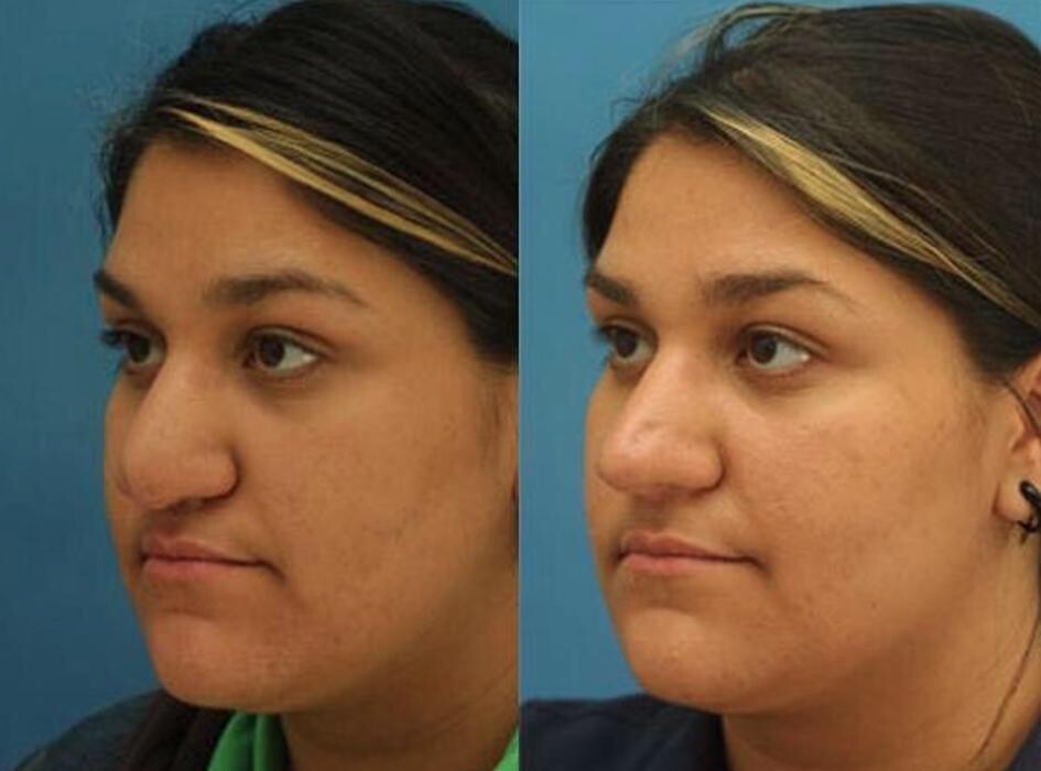 Images Gotham Plastic Surgery