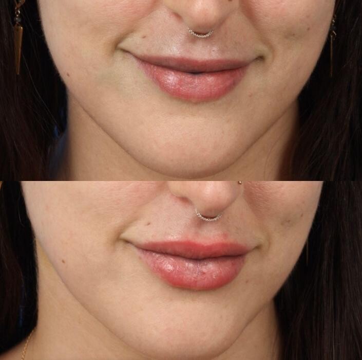 Images Gotham Plastic Surgery