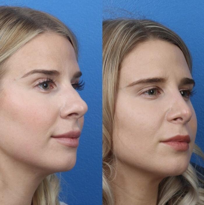 Images Gotham Plastic Surgery