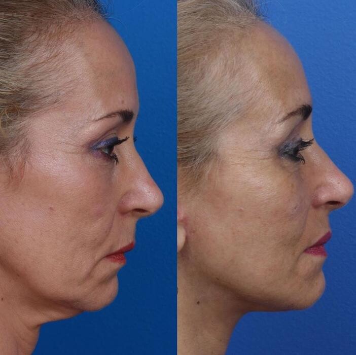 Images Gotham Plastic Surgery