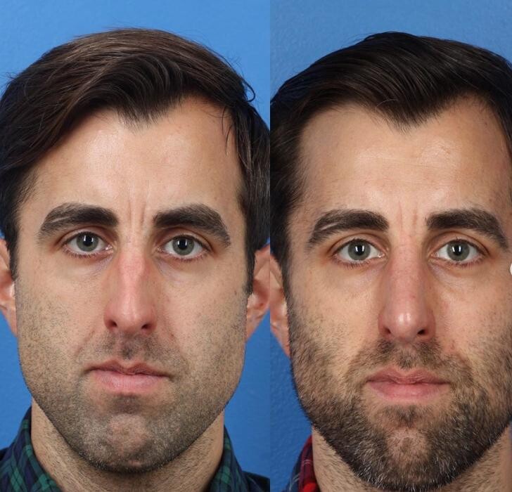 Images Gotham Plastic Surgery