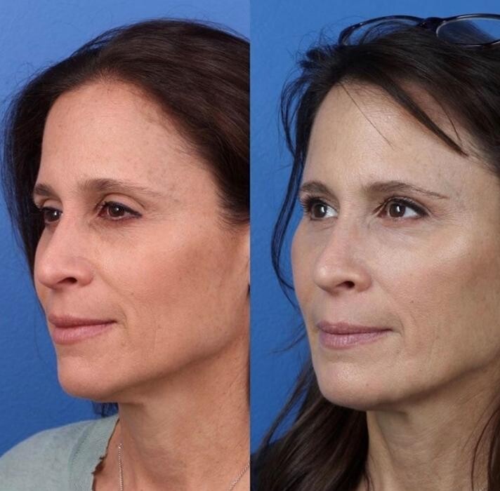 Images Gotham Plastic Surgery