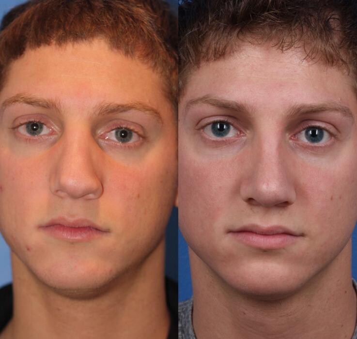 Images Gotham Plastic Surgery