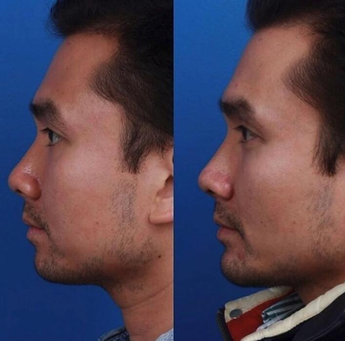 Images Gotham Plastic Surgery