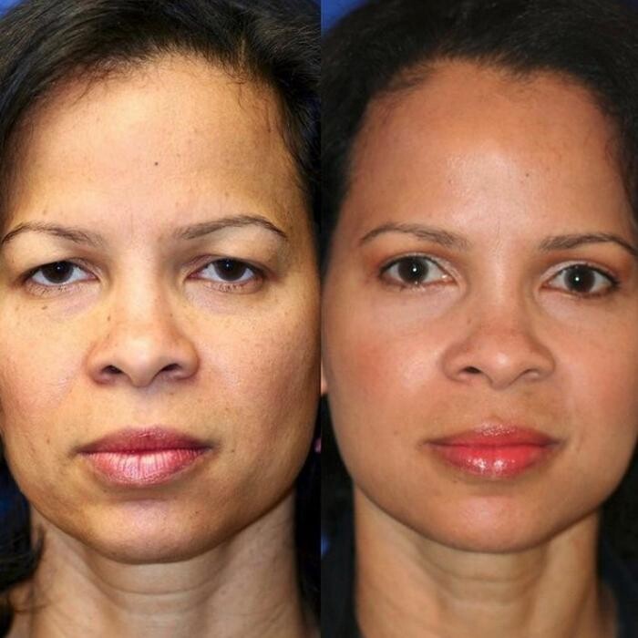 Images Gotham Plastic Surgery